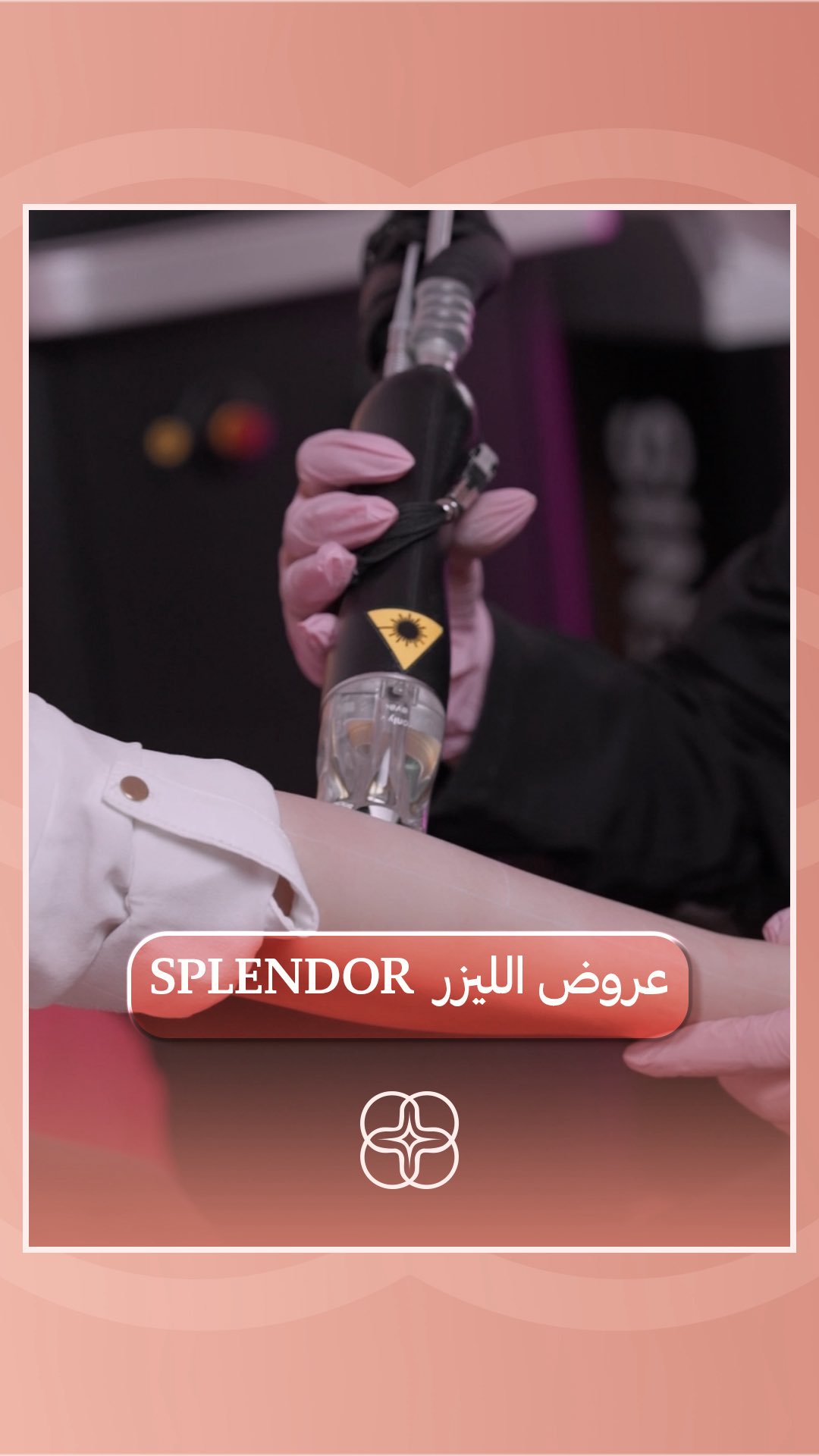 عروض الليزر